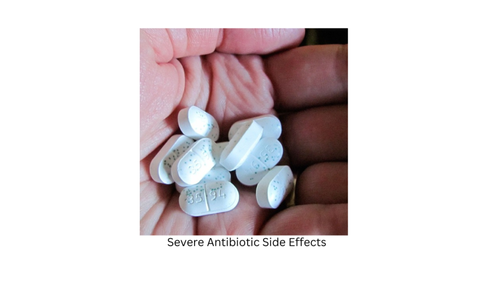 Prevention Strategies for Severe Antibiotic Side Effects