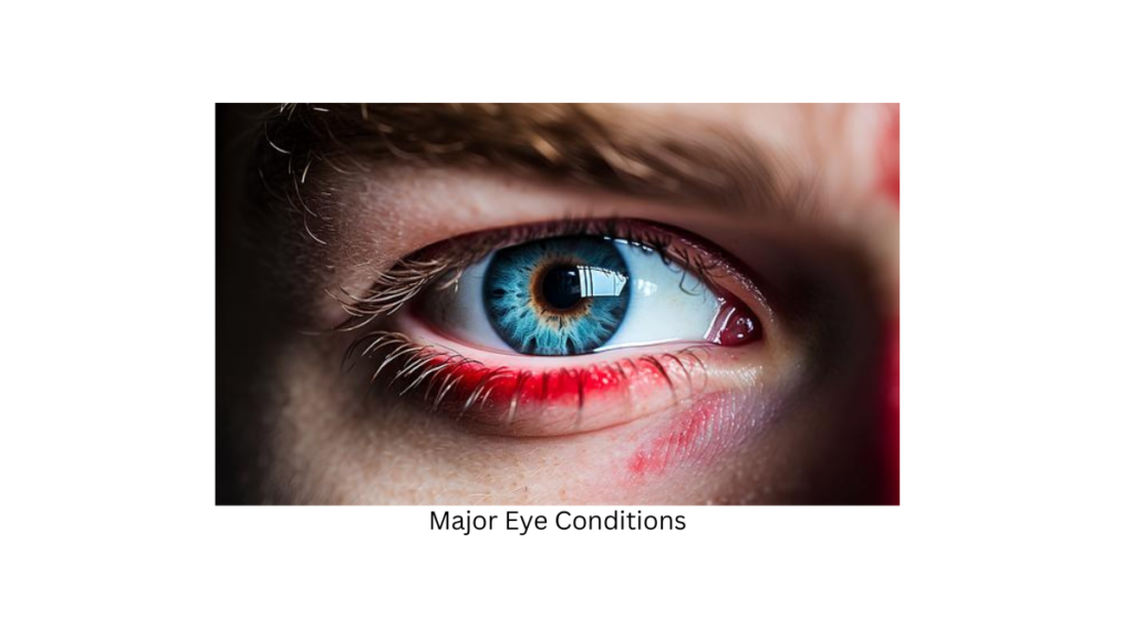 Major Eye Conditions: Causes, Symptoms, and Treatment Options