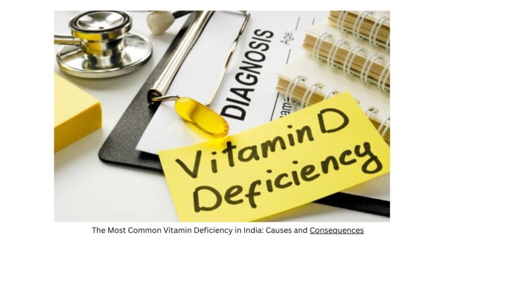 Vitamin D, often referred to as the "sunshine vitamin," plays a crucial role in maintaining bone health, supporting the immune system, and regulating various bodily functions. The primary source of vitamin D is sunlight, which triggers its synthesis in the skin. However, a large proportion of the Indian population faces challenges in obtaining an adequate amount of sunlight, leading to a high prevalence of Vitamin D deficiency.