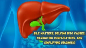 Bile Matters: Delving into Causes, Navigating Complications, and Simplifying Diagnosis