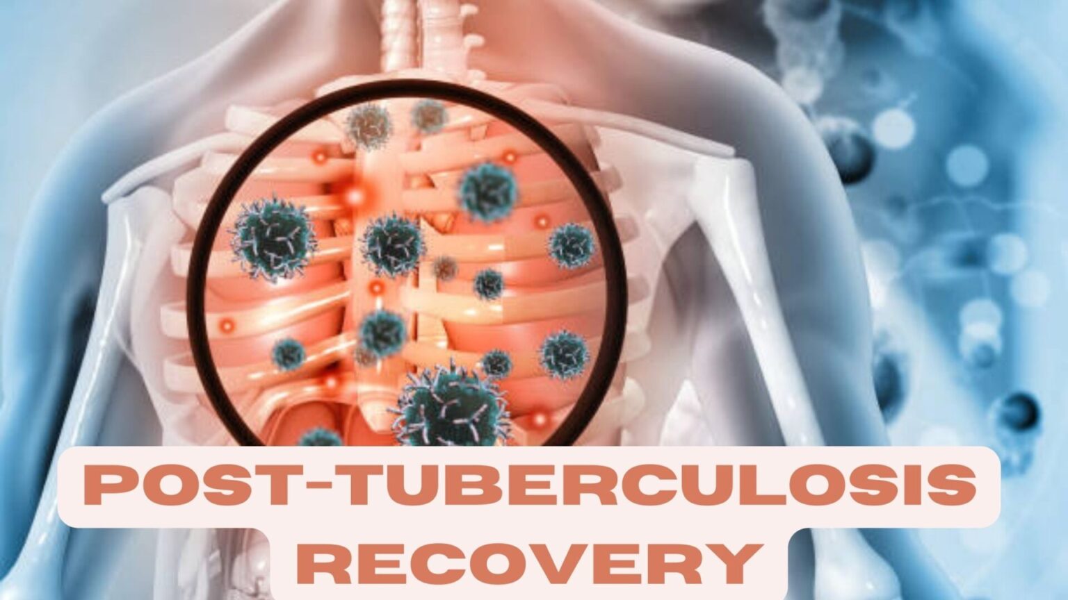 Post-Tuberculosis Recovery