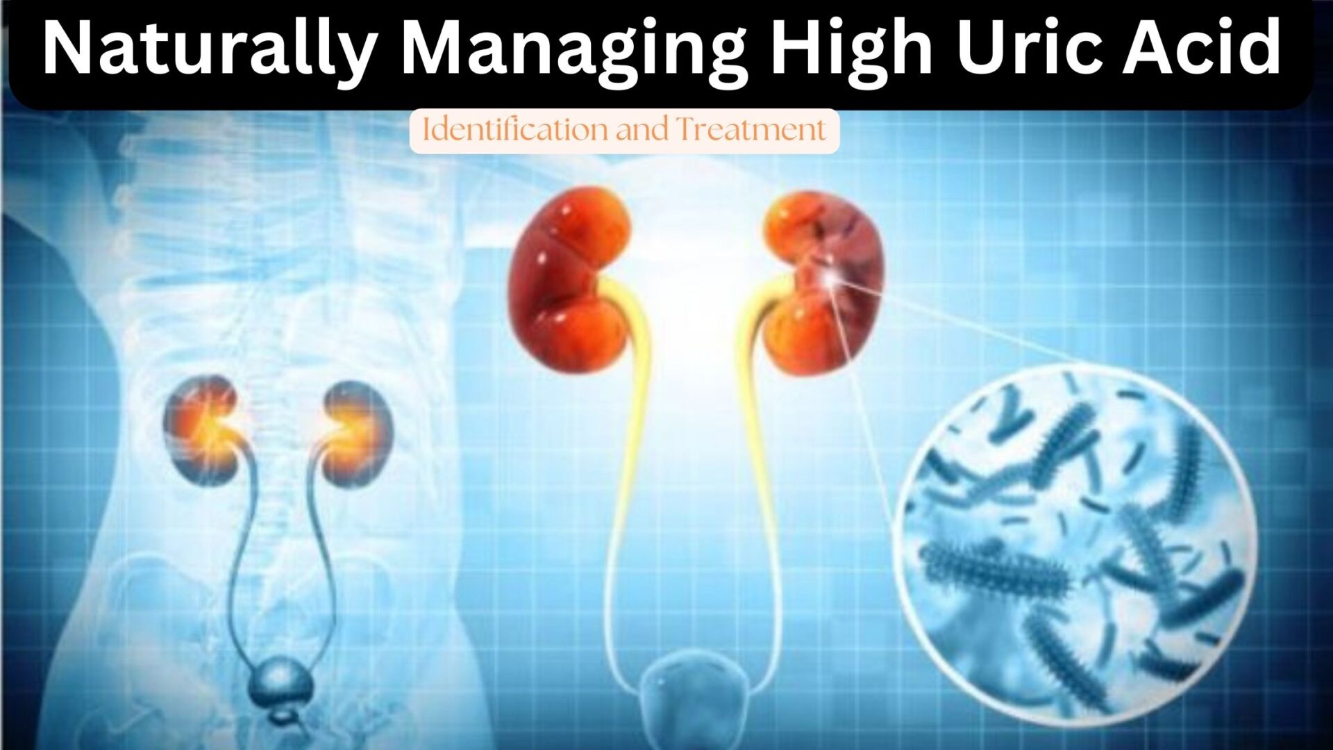 Naturally Managing High Uric Acid: Identification and Treatment