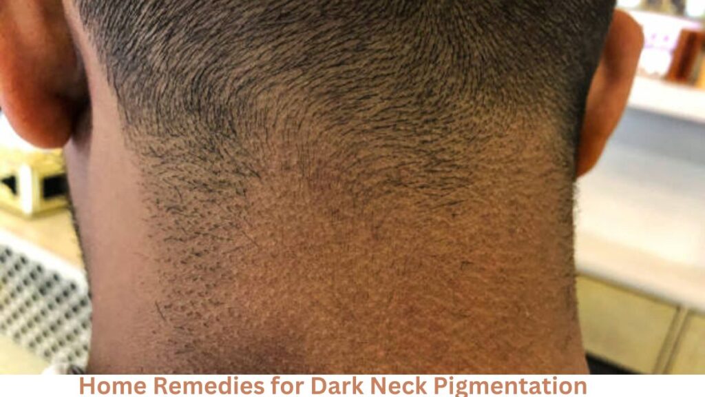 Home Remedies for Dark Neck Pigmentation