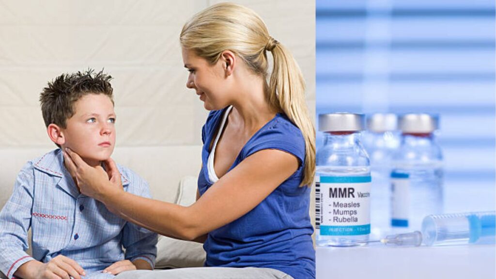 Children's health is very important for the future. A viral infection called the mumps virus can make children very sick. This article will talk about how the mumps virus affects children's health, what the symptoms are, what problems it can cause, and how to prevent children from getting it.