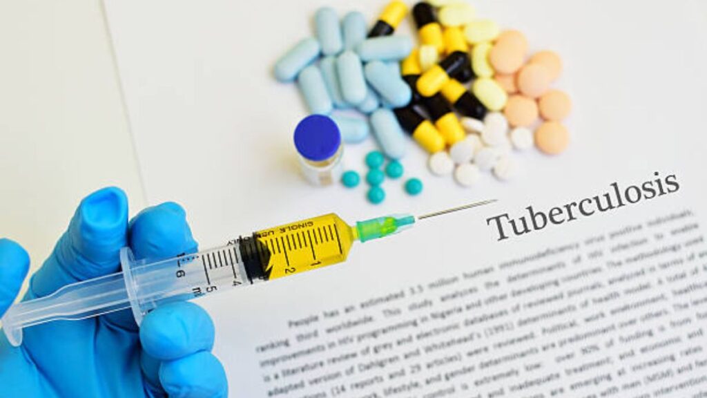 "BCG Doses: The Shield Against Tuberculosis for Adults"