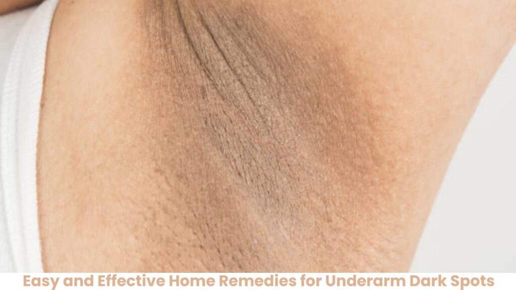 Easy and Effective Home Remedies for Underarm Dark Spots