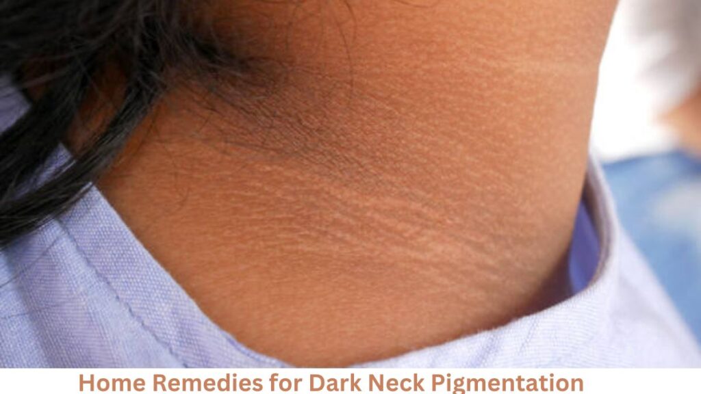 Home Remedies for Dark Neck Pigmentation