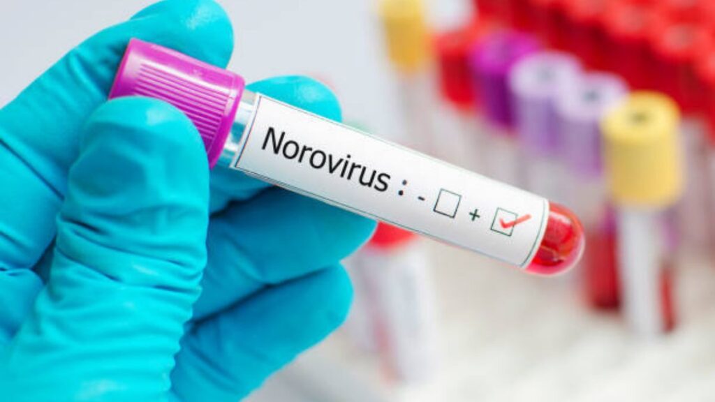 Norovirus, a highly contagious virus, leads the charge as a prevalent source of gastroenteritis, affecting people across all age groups with symptoms such as vomiting, diarrhea, and stomach pain. It stands out as the primary culprit behind approximately 20 million illnesses annually, including tens of thousands of hospitalizations and hundreds of fatalities, making guarding against Norovirus an essential endeavor for public health. Additionally, Norovirus proudly holds the title for being the leading cause of foodborne illness outbreaks in Minnesota, emphasizing the critical need for effective norovirus protection strategies.