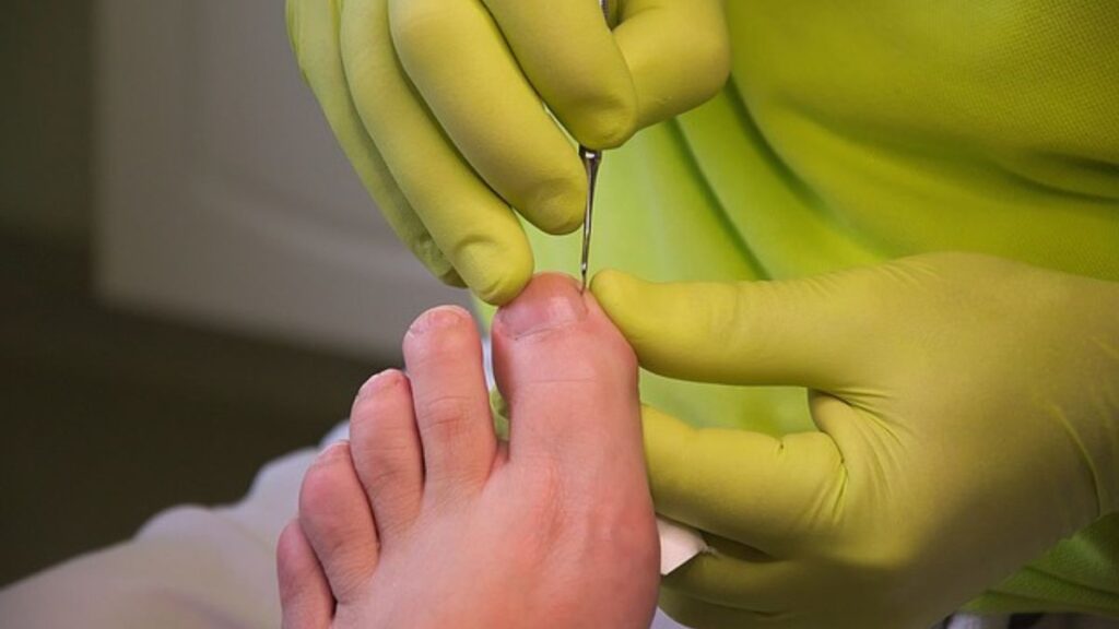 Rainy Day Foot Care: Essential Tips for Healthy, Fungus-Free Feet