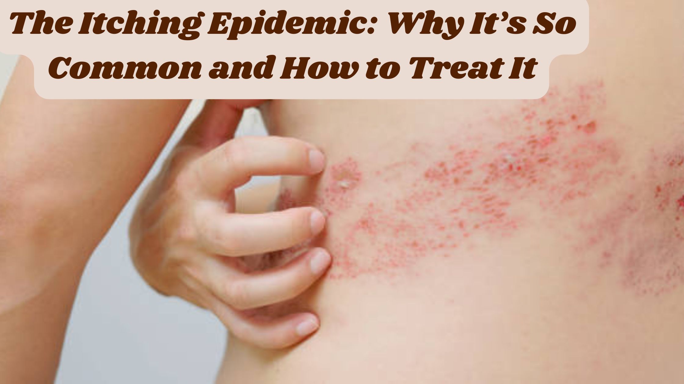 The Itching Epidemic: Why It’s So Common and How to Treat It