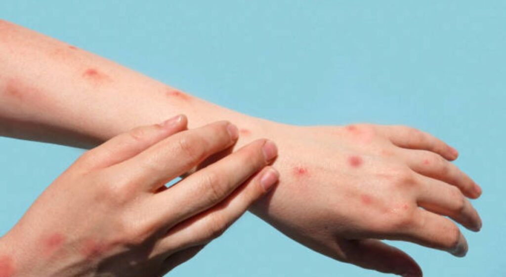 The Itching Epidemic: Why It’s So Common and How to Treat It