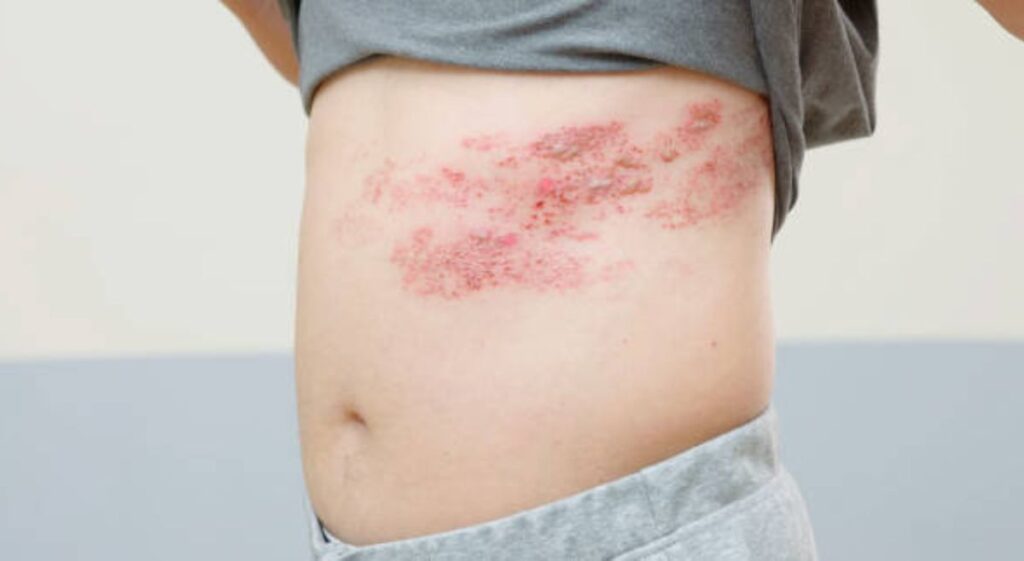 The Itching Epidemic: Why It’s So Common and How to Treat It